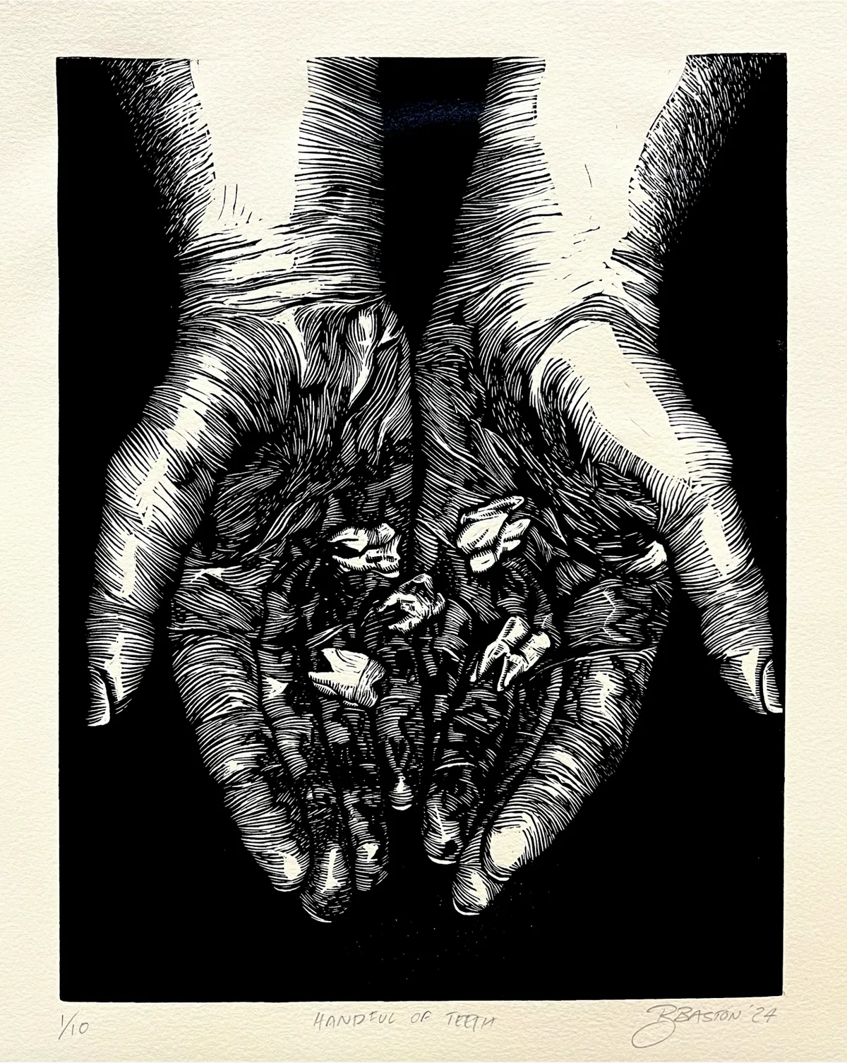 Handful of Teeth
